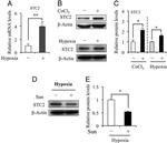 STC2 Antibody in Western Blot (WB)