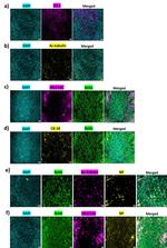 MUC5AC Antibody in Immunohistochemistry (IHC)