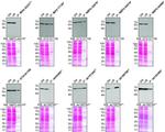 Moesin Antibody in Western Blot, Immunoprecipitation (WB, IP)