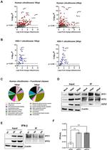 IFIT1 Antibody in Western Blot (WB)