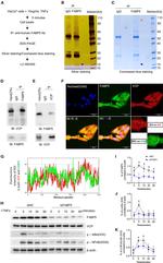 FABP5 Antibody in Western Blot (WB)
