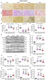 SMAD3 Antibody in Western Blot (WB)