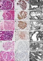EXT1 Antibody in Immunohistochemistry (IHC)