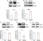 Pannexin 1 Antibody in Western Blot (WB)