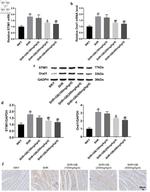 STIM1 Antibody in Immunohistochemistry (IHC)