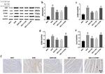 STIM1 Antibody in Western Blot, Immunohistochemistry (WB, IHC)