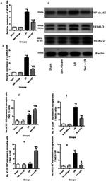 NFkB p65 Antibody in Western Blot (WB)