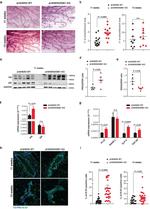 Progesterone Receptor Antibody in Western Blot (WB)