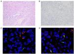MSH2 Antibody in Immunohistochemistry (IHC)