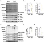 O-linked N-acetylglucosamine (O-GlcNAc) Antibody in Western Blot (WB)