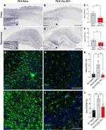 Phospho-Tau (Ser202, Thr205) Antibody in Immunohistochemistry (IHC)