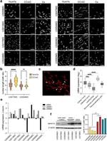 Lamin A Antibody in Western Blot (WB)