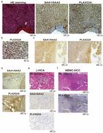 PLA2G2A Antibody in Immunohistochemistry (IHC)