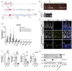 Villin Antibody in Western Blot (WB)