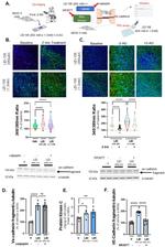 VE-cadherin Antibody in Western Blot (WB)