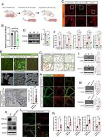 PMCA2 ATPase Antibody in Western Blot (WB)