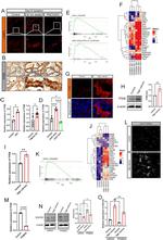 TFEB Antibody in Western Blot, Immunohistochemistry (WB, IHC)
