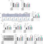 NAMPT Antibody in Western Blot (WB)
