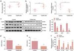 Apelin Antibody in Western Blot (WB)