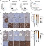 CRMP5 Antibody in Immunohistochemistry (IHC)
