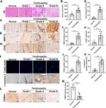 MURF3 Antibody in Immunohistochemistry (IHC)