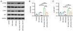 AKT Pan Antibody in Western Blot (WB)