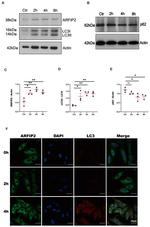 Arfaptin 2 Antibody in Western Blot (WB)