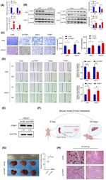 PTBP1 Antibody in Western Blot (WB)