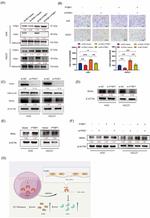 PTBP1 Antibody in Western Blot (WB)