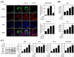 SQSTM1 Antibody in Western Blot (WB)