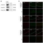 Claudin 18 Antibody in Western Blot (WB)