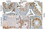 Estrogen Receptor beta Antibody in Immunohistochemistry (IHC)