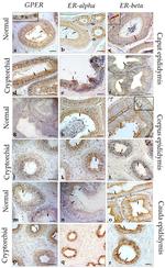 Estrogen Receptor beta Antibody in Immunohistochemistry (IHC)