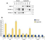 Estrogen Receptor beta Antibody in Western Blot (WB)