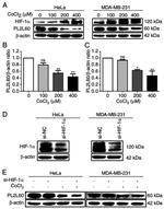 Actin Antibody in Western Blot (WB)