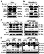 Actin Antibody in Western Blot (WB)
