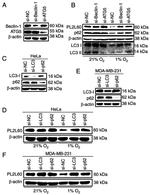Actin Antibody in Western Blot (WB)