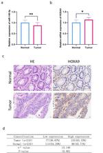 HOXA9 Antibody in Immunohistochemistry (IHC)