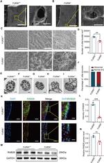 RAB28 Antibody in Western Blot (WB)