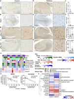Phospho-Tau (Thr217) Antibody in Immunohistochemistry (IHC)