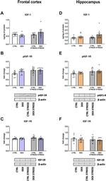 IGF1R beta Antibody in Western Blot (WB)