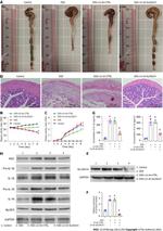 SLC6A14 Antibody in Western Blot (WB)