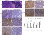Synaptophysin Antibody in Immunohistochemistry (IHC)