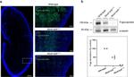 P glycoprotein Antibody in Western Blot (WB)