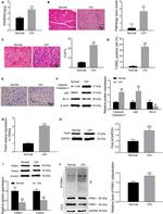 Parkin Antibody in Western Blot (WB)