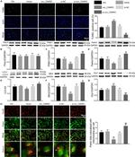 Parkin Antibody in Western Blot (WB)