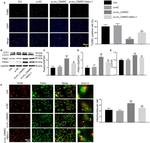 Parkin Antibody in Western Blot (WB)