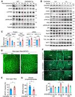 NFkB p65 Antibody in Western Blot (WB)