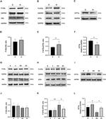 CPT1B Antibody in Western Blot (WB)