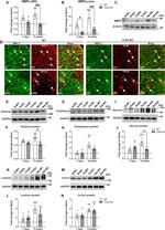 Versican Antibody in Western Blot (WB)